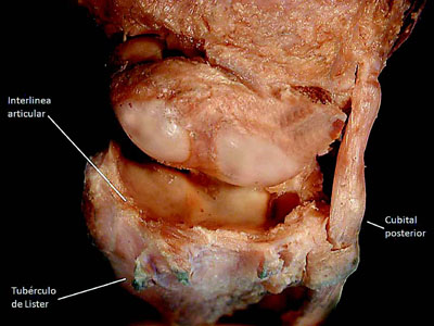 Fig_4