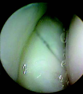 Fig_6