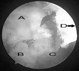 fig1