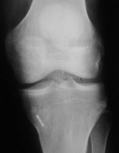 fig2b