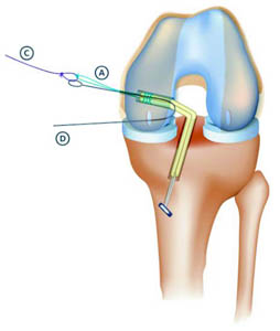 fig3
