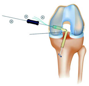 fig4