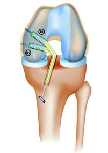 fig6