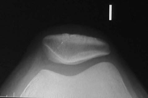 fig1