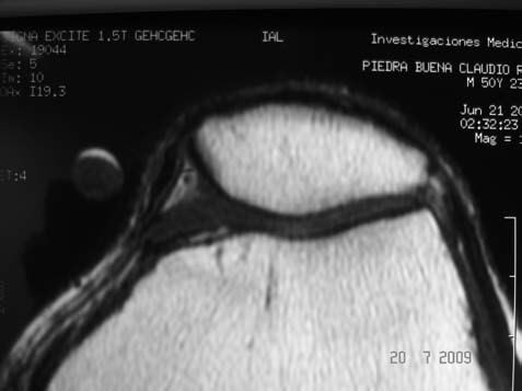 fig2a