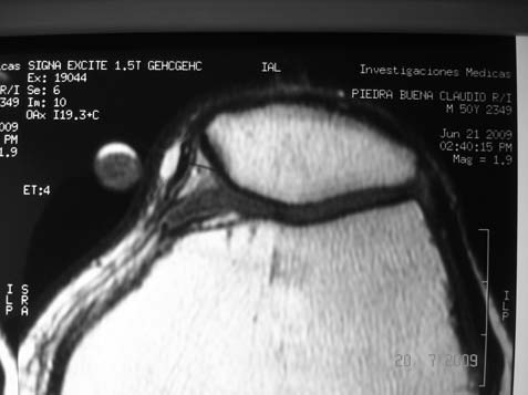 fig2b