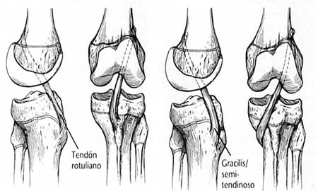 fig2