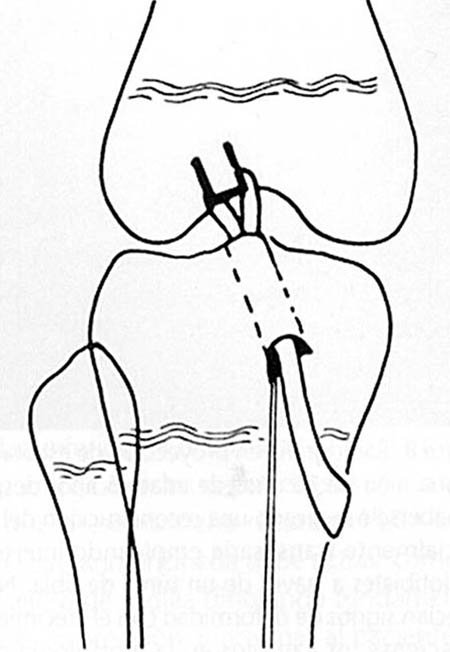 fig3