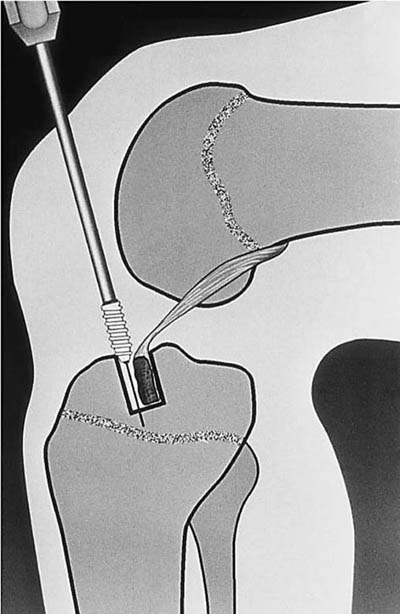 fig4