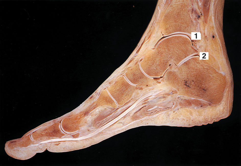 figura13