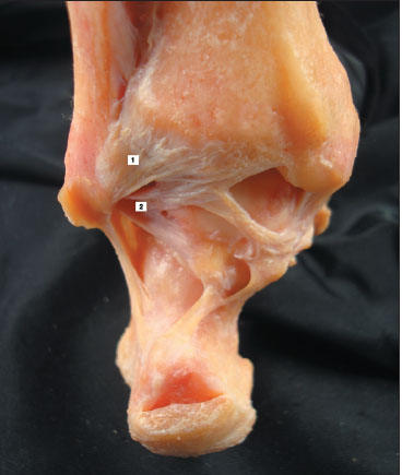 figura3