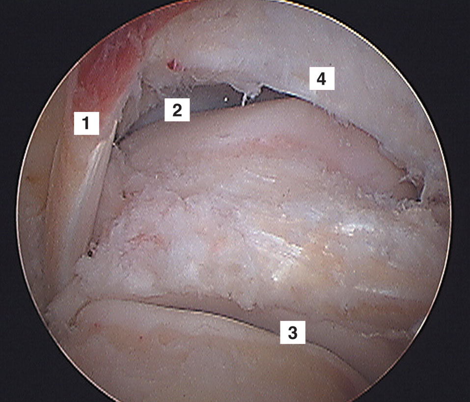 figura4