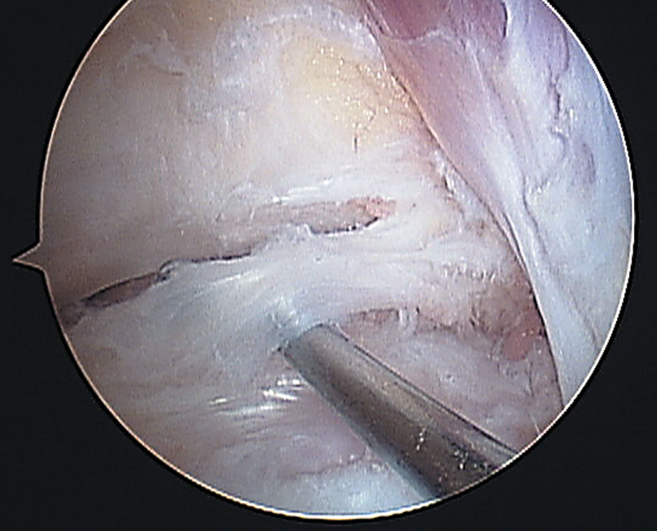 figura8