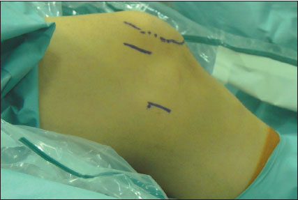 figura4
