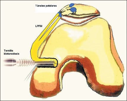 figura7