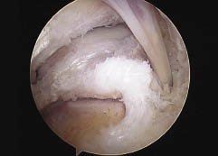18_02_02_fig3b