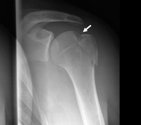 18_03_02_fig1