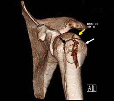 18_03_02_fig1b