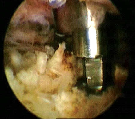 18_03_02_fig1d