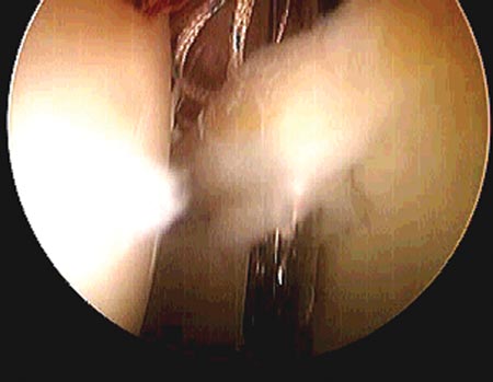 18_03_04_fig11