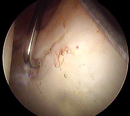18_03_04_fig3
