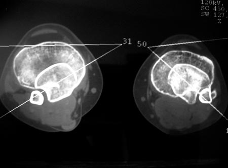 18_03_05_Fig4a