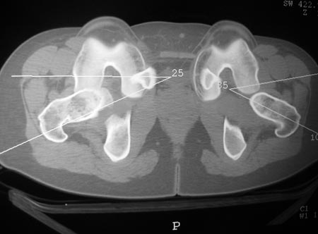 18_03_05_Fig4b