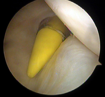 maestu1_fig1