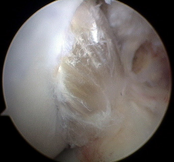 maestu1_fig10