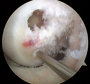 maestu1_fig3