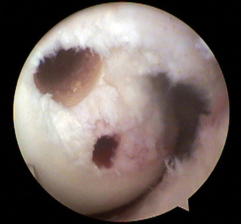 maestu1_fig4