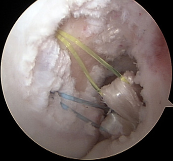 maestu1_fig6