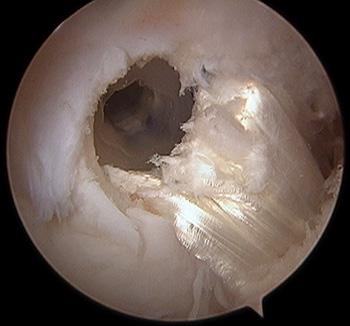 maestu1_fig7