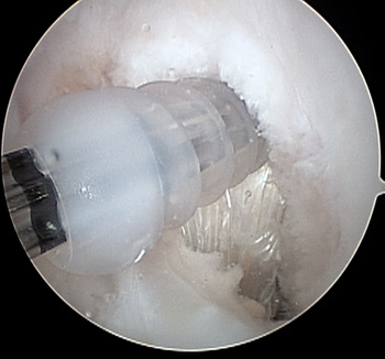 maestu1_fig9