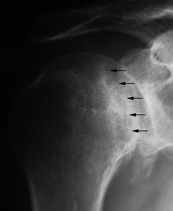 barclay_fig2