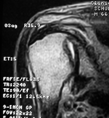 barclay_fig3a