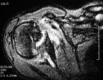 barclay_fig3b