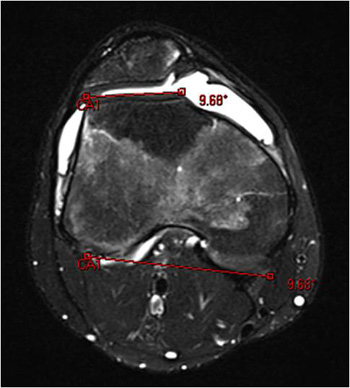 Fig1Bcopy