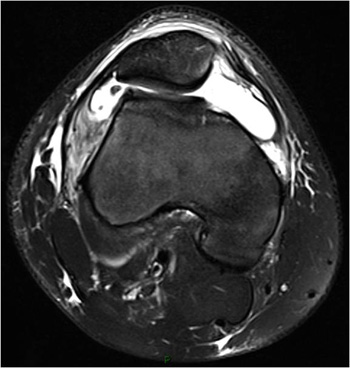 Fig2Acopy