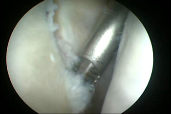 Fig1acopy