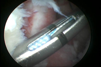 Fig3bcopy