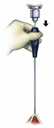 fig2acopy