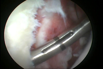 fig2bcopy